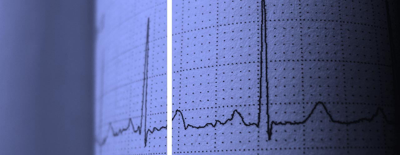 HRV - heart rate variability (variabilidade do batimento cardíaco)
